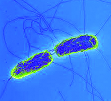 DK: Illustration af salmonellabakterie. Foto: DTU Fødevareinstituttet | EN: Illustration of salmonella bacteria. Photo: National Food Institute, Technical University of Denmark