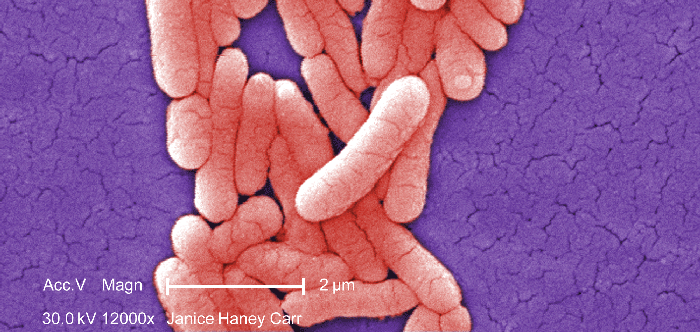 Photo: Centers for Disease Control and Prevention