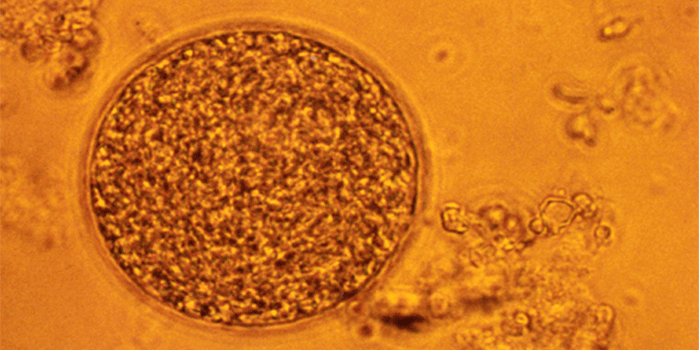 Photo: Host cell from a mouse brain packed with the bradyzoite stage of the parasite Toxoplasma gondii. Source: Statens Serum Institut
