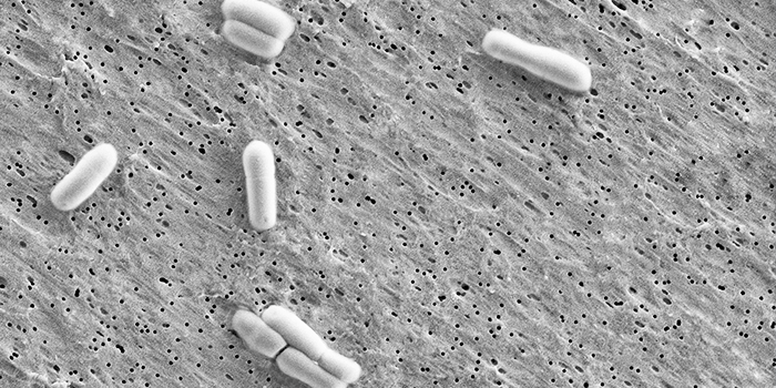 Bifidobacterium-animalis-subsp - photo: Chr. Hansen