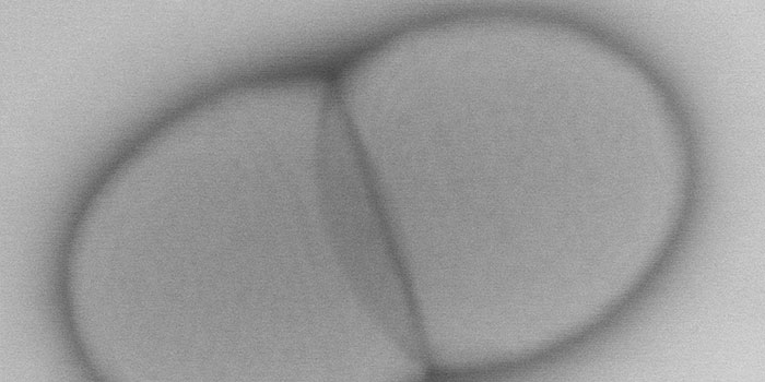 Lactococcus lactis. Foto: Ramona Valentina Mateiu
