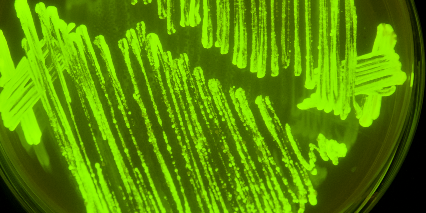 DTU Fødevareinstituttet DK: E. coli. Foto: DTU Fødevareinstituttet | EN: E. coli. Photo: National Food Institute, Technical University of Denmark