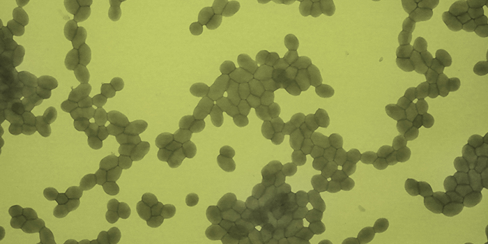DK: Mælkesyrebakterier. Foto: Ramona Valentina Mateiu | EN:  Lactic acid bacteria. Photo: Ramona Valentina Mateiu