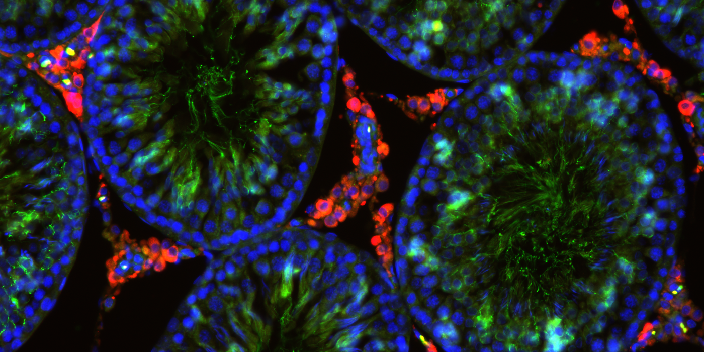 DK: Immunofarvet snit af rotte testikkel. Foto: DTU Fødevareinstituttet | EN: Immunostained section of rat testicle. Photo: DTU National Food Institute