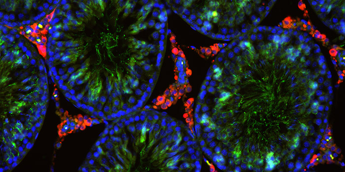 DK: Immunofarvet snit af rotte testikkel. Foto: DTU Fødevareinstituttet | EN: Immunostained section of rat testicle. Photo: National Food Institute, Technical University of Denmark
