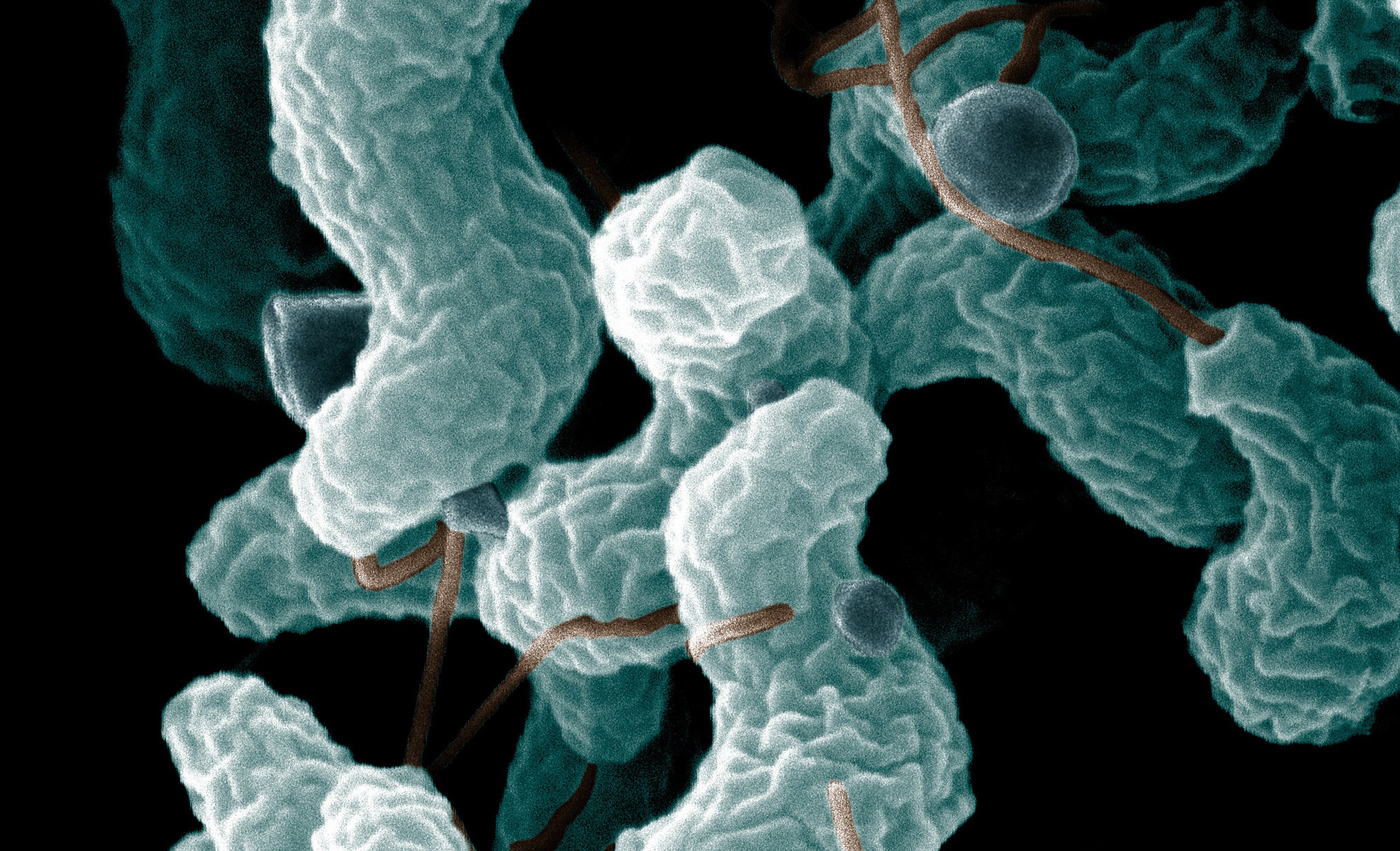Foto af campylobacter