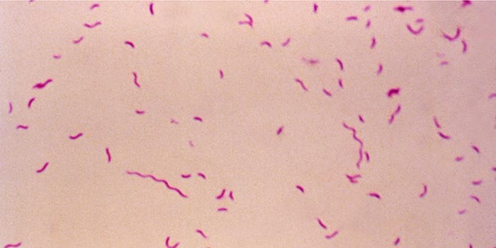 Campylobacterbakterier. Foto: CDC - Centers for Disease Control and Prevention Campylobacterbakterier. Foto: CDC - Centers for Disease Control and Prevention