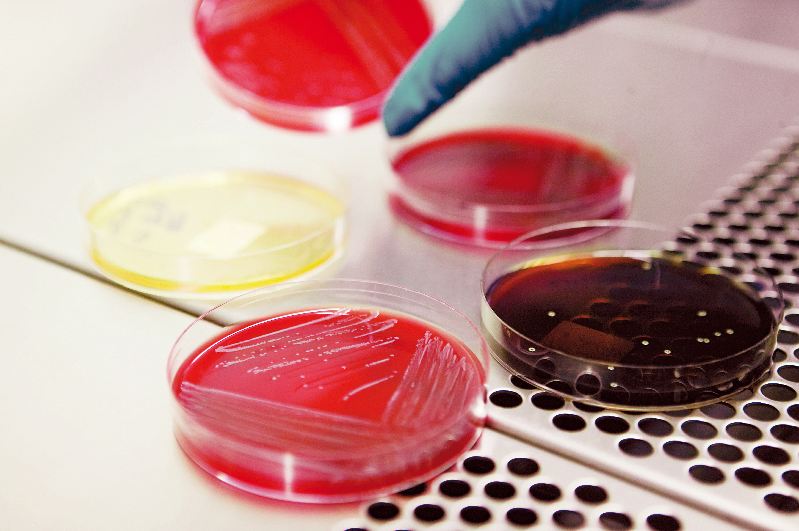Test af listeria