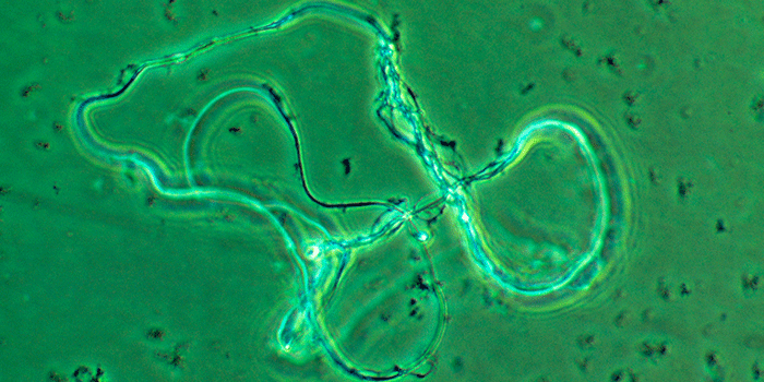 Image: Human DNA. Philippe Plailly, Science Photo Library, Scanpix