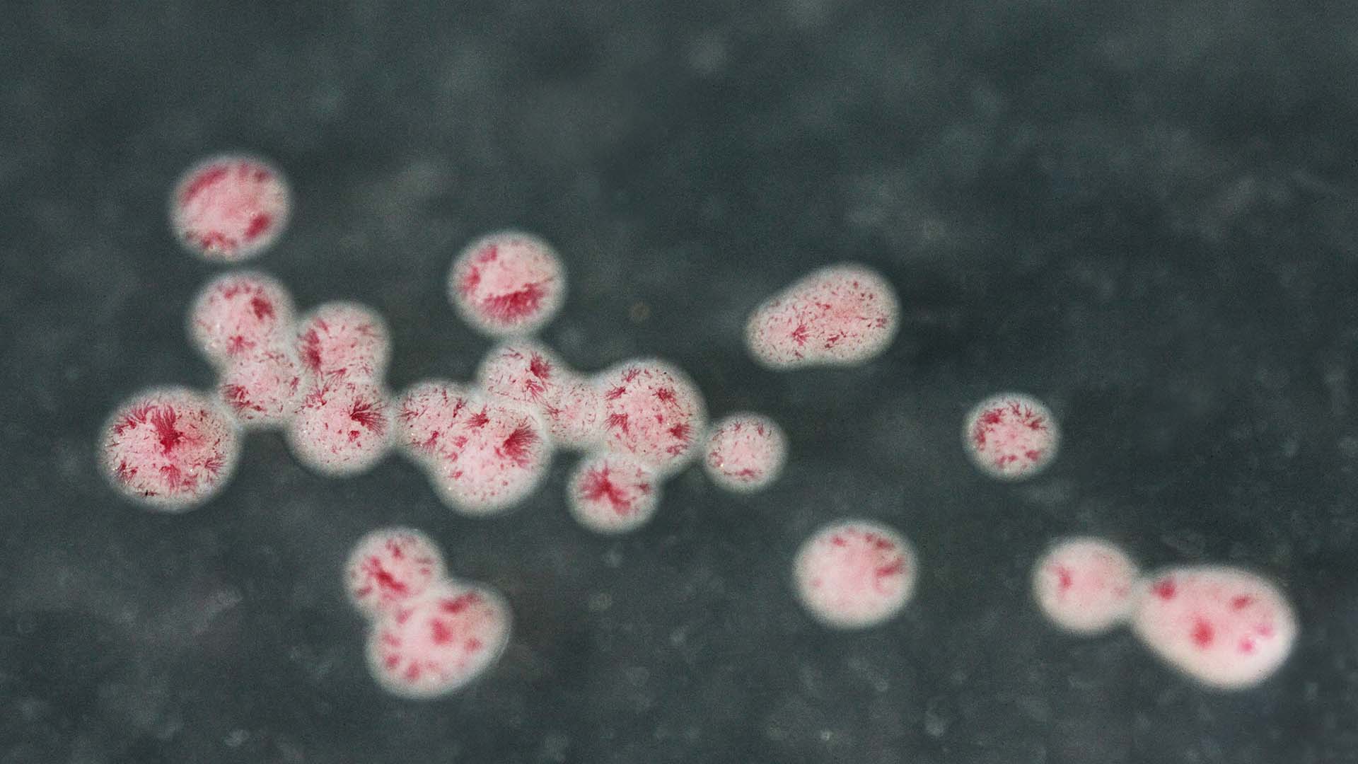 DK: Tarmbakterier. Foto: Jesper Scheel | EN: Intestinal bacteria. Photo: Jesper Scheel