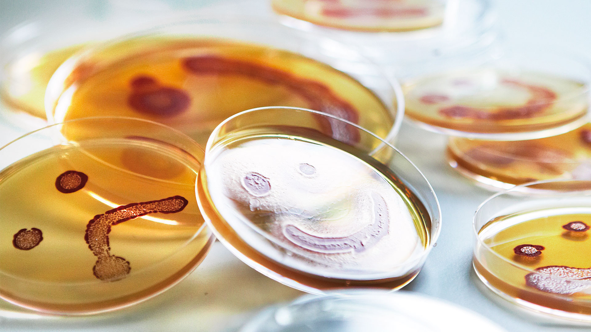 Campylobacter-Foto-Mikkel-Adsbøl.