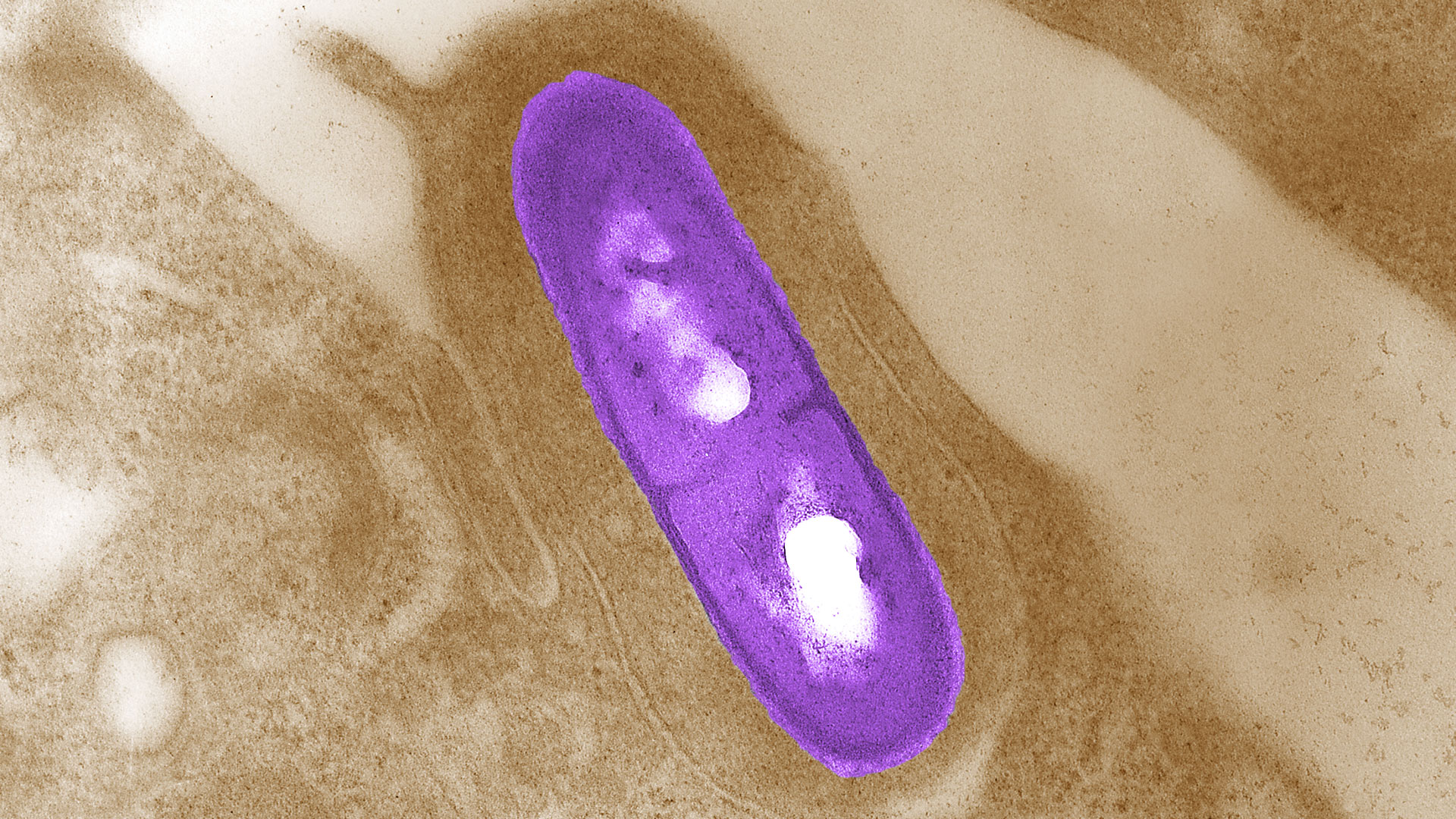 One-health-Listeria-DTU National Food Institute