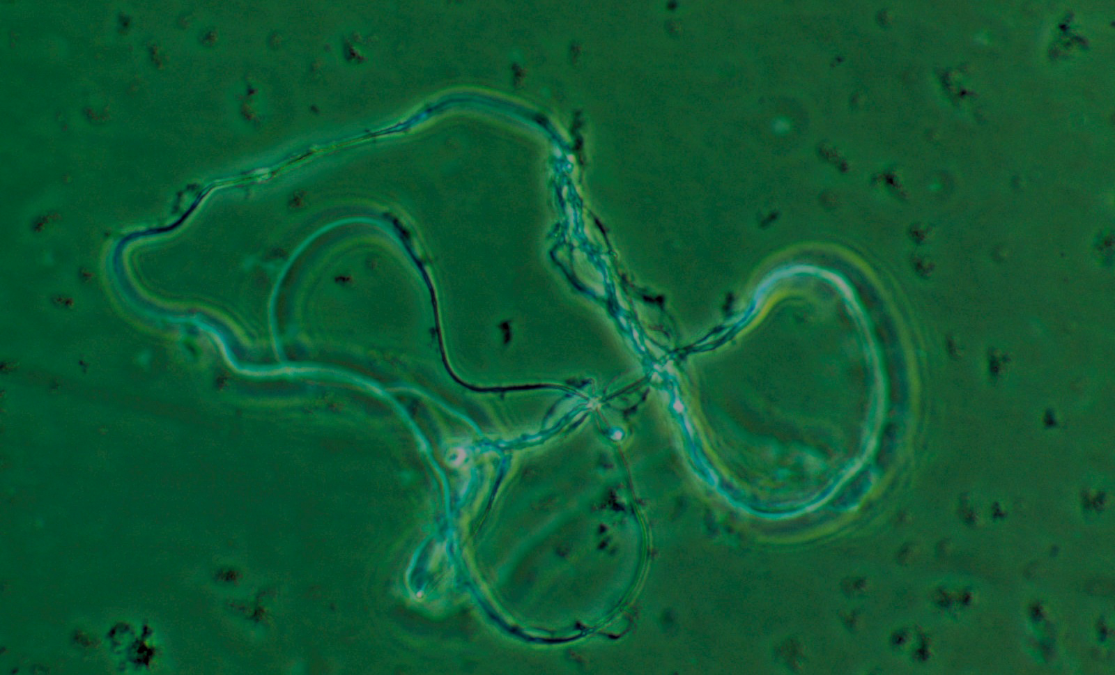 ANTIBIOTIKARESISTENS DK: Menneskelig DNA. Foto: Philippe Plailly/Science Photo Library/Ritzau Scanpix | EN: Human DNA. Photo: Philippe Plailly/Science Photo Library/Ritzau Scanpix