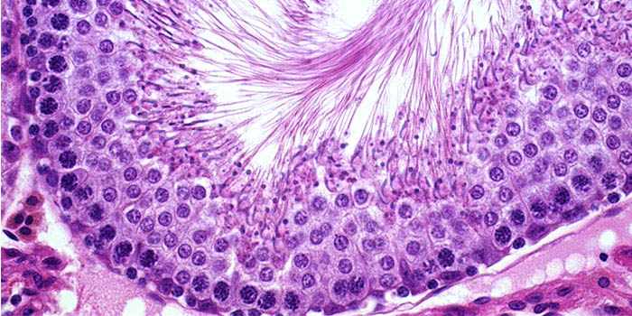 DK: Testikelvævfra rotte. Foto: DTU Fødevareinstituttet | EN: Testicular tissuefrom rat . Photo: National Food Institute, Technical University of Denmark