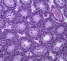 DK: Testikel fra rotteunge. Foto: DTU Fødevareinstituttet | EN: Testicle from rat pup. Photo: National Food Institute, Technical University of Denmark