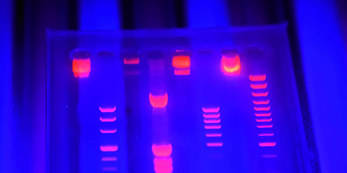 DK: Geleletroforese. Foto: Mikkel Adsbøl | EN: Gel electrophoresis. Photo: Mikkel Adsbøl