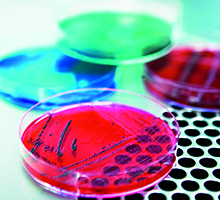 DK: Agarplade (Listeria) . Foto: Mikkel Adsbøl | EN:  Agar plate (Listeria). Photo: Mikkel Adsbøl