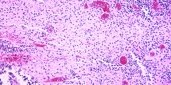 DK: Salmonella typhi. Foto: CDC/ Armed Forces Institute of Pathology, Charles N. Farmer| EN: Salmonella typhi. Photo: CDC/ Armed Forces Institute of Pathology, Charles N. Farmer